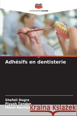 Adhésifs en dentisterie Shefali Dogra, Piyush Tandan, Mansi Nautiyal 9786204155210 Editions Notre Savoir - książka