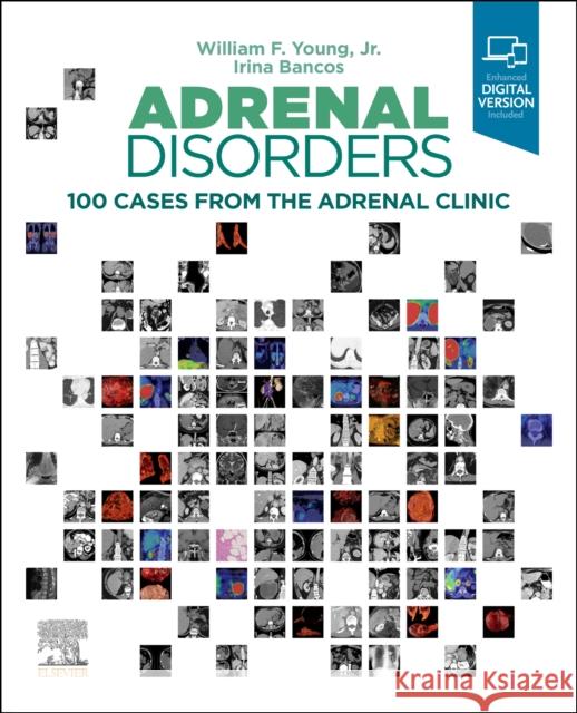 Adrenal Disorders: 100 Cases from the Adrenal Clinic William F. Young Irina Bancos 9780323792851 Elsevier - Health Sciences Division - książka