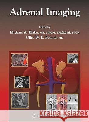 Adrenal Imaging  9781934115862 HUMANA PRESS INC.,U.S. - książka