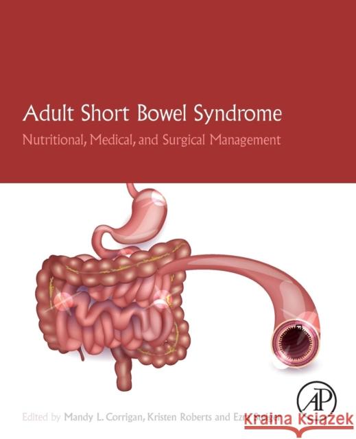 Adult Short Bowel Syndrome: Nutritional, Medical, and Surgical Management Mandy L. Corrigan Kristen Roberts Ezra Steiger 9780128143308 Academic Press - książka