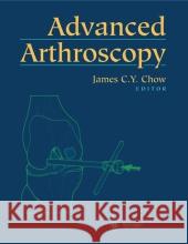 Advanced Arthroscopy James C. Y. Chow James C. Y. Chow R. W. Jackson 9780387988085 Springer, Berlin - książka