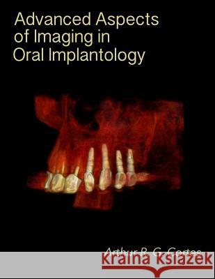 Advanced Aspects of Imaging in Oral Implantology Arthur Rodriguez Gonzalez Cortes 9781515311508 Createspace - książka