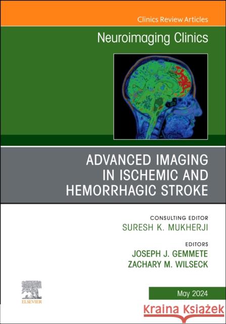 Advanced Imaging in Ischemic and Hemorrhagic Stroke, An Issue of Neuroimaging Clinics of North America  9780443131332 Elsevier - książka