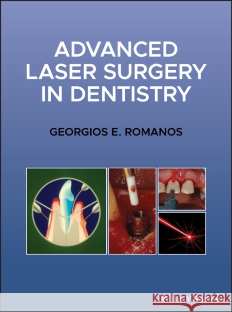 Advanced Laser Surgery in Dentistry Romanos, Georgios E. 9781119583301 Wiley-Blackwell - książka