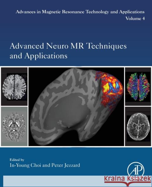 Advanced Neuro MR Techniques and Applications: Volume 4 Choi, In-Young 9780128224793 Academic Press - książka