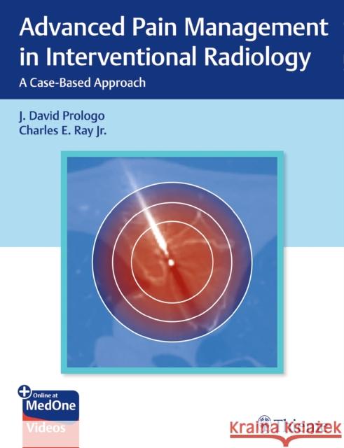 Advanced Pain Management in Interventional Radiology: A Case-Based Approach Charles Ray 9781684201402 Thieme, Stuttgart - książka