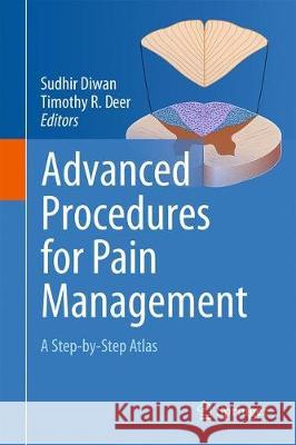 Advanced Procedures for Pain Management: A Step-By-Step Atlas Diwan, Sudhir 9783319688398 Springer - książka