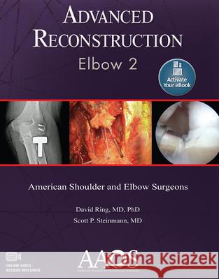 Advanced Reconstruction: Elbow 2: Print + eBook with Multimedia Ring, David 9781975123437 AAOS - książka