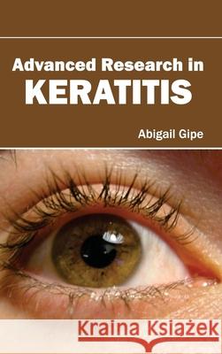 Advanced Research in Keratitis Abigail Gipe 9781632420251 Foster Academics - książka