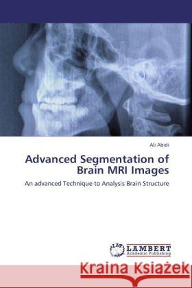 Advanced Segmentation of Brain MRI Images Ali Abidi 9783847345749 LAP Lambert Academic Publishing - książka