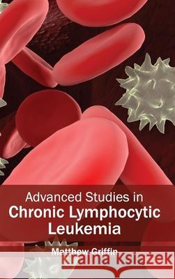 Advanced Studies in Chronic Lymphocytic Leukemia Matthew Griffin 9781632410153 Hayle Medical - książka
