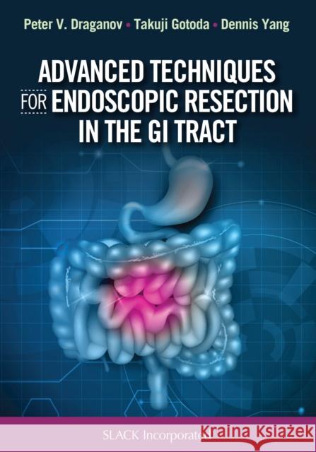 Advanced Techniques for Endoscopic Resection in the GI Tract Peter Vassilev Draganov Takuji Gotoda Dennis Yang 9781630914592 Slack - książka