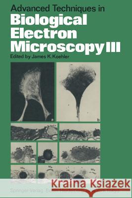 Advanced Techniques in Biological Electron Microscopy III J. K. Koehler A. P. Aguas M. F. Barbosa 9783540164005 Springer - książka