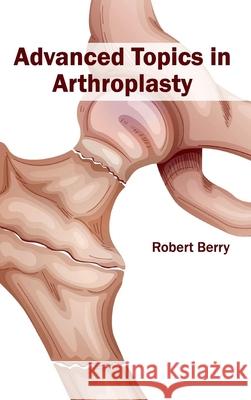 Advanced Topics in Arthroplasty Robert Berry 9781632410207 Hayle Medical - książka