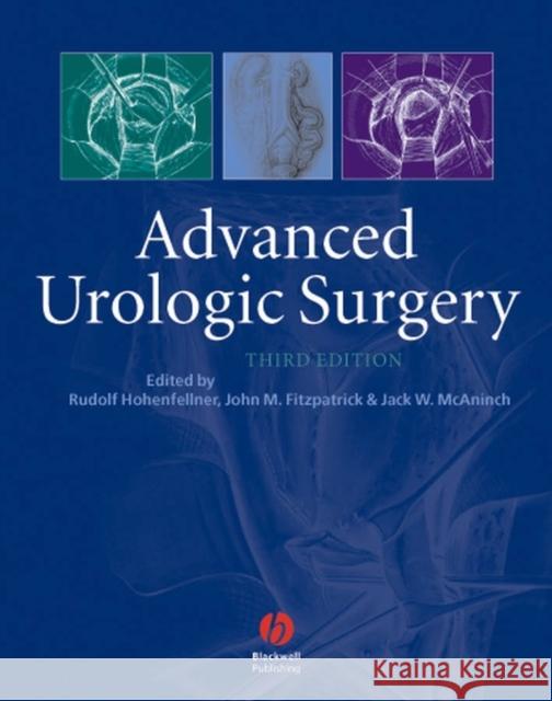 Advanced Urologic Surgery Jack McAninch Rudolph Hohenfellner 9781405122139 Blackwell Publishing Professional - książka