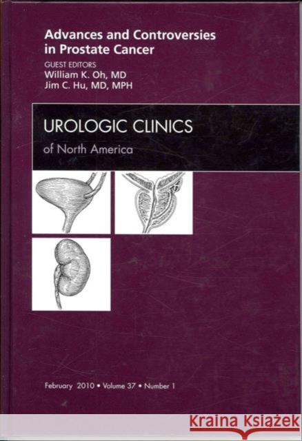Advances and Controversies in Prostate Cancer, an Issue of Urologic Clinics: Volume 37-1 Oh, William 9781437719161 W.B. Saunders Company - książka