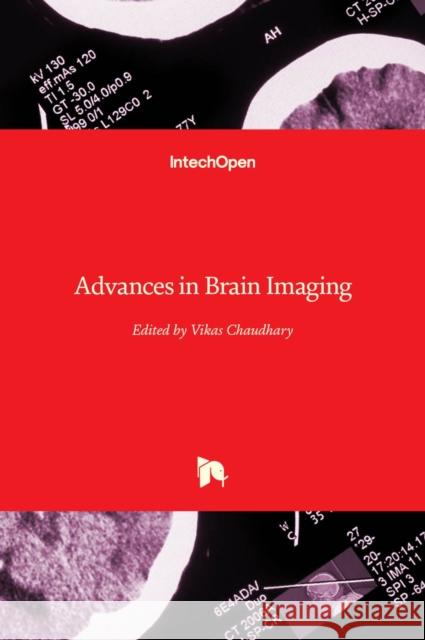 Advances in Brain Imaging Vikas Chaudhary 9789533079554 Intechopen - książka