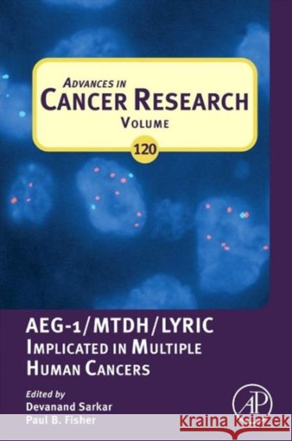 Advances in Cancer Research: Aeg-1/Mtdh/Lyric Implicated in Multiple Human Cancers Volume 120 Sarkar, Devanand 9780124016767  - książka