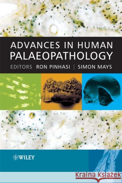 Advances in Human Palaeopathology Ron Pinhasi 9780470036020 John Wiley & Sons - książka