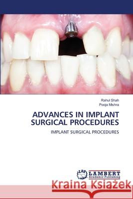 Advances in Implant Surgical Procedures Rahul Shah Pooja Mishra 9786207640935 LAP Lambert Academic Publishing - książka