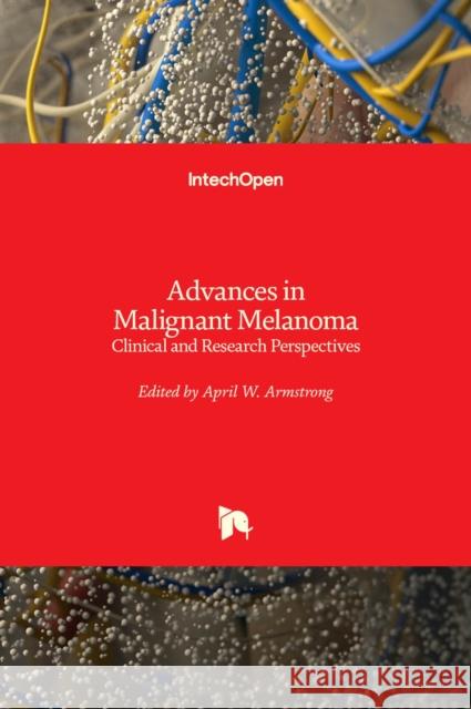Advances in Malignant Melanoma: Clinical and Research Perspectives April Armstrong 9789533075754 Intechopen - książka