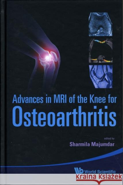 Advances in MRI of the Knee for Osteoarthritis Blumenfeld, Janet 9789814271707 World Scientific Publishing Company - książka