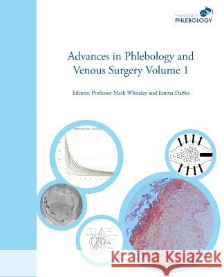 Advances in Phlebology and Venous Surgery Volume 1 Whiteley, Mark Steven 9781908586032 Whiteley Publishing Ltd - książka