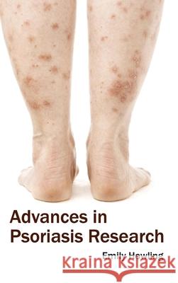 Advances in Psoriasis Research Emily Howling 9781632420350 Foster Academics - książka