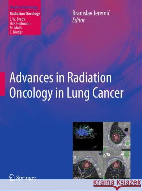 Advances in Radiation Oncology in Lung Cancer Branislav Jeremic 9783642199240 Springer - książka