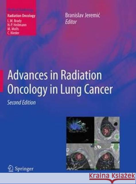 Advances in Radiation Oncology in Lung Cancer Branislav Jeremic 9783662499795 Springer - książka