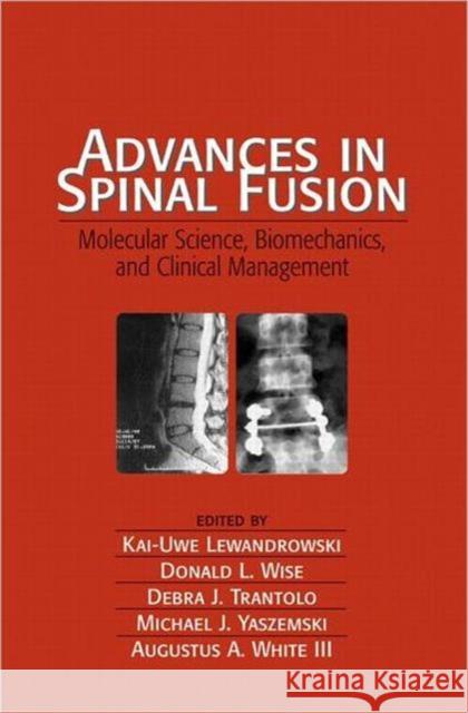 Advances in Spinal Fusion: Molecular Science, Biomechanics, and Clinical Management Lewandrowski, Kai-Uwe 9780824743109 CRC - książka