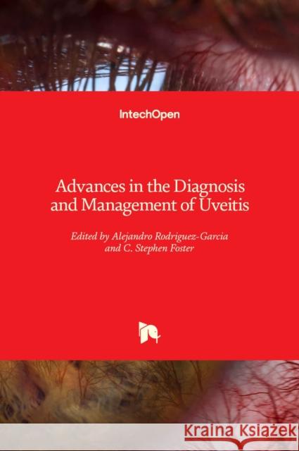 Advances in the Diagnosis and Management of Uveitis Alejandro Rodriguez-Garcia C. Stephen Foster 9781838805425 Intechopen - książka
