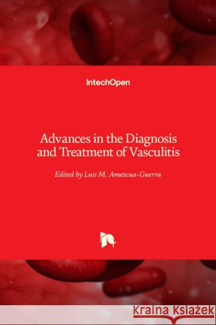 Advances in the Diagnosis and Treatment of Vasculitis Luis M. Amezcua-Guerra 9789533077864 Intechopen - książka