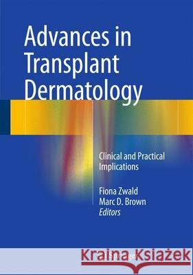 Advances in Transplant Dermatology: Clinical and Practical Implications Zwald, Fiona 9783319124445 Springer - książka