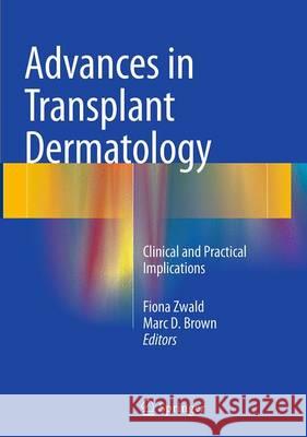 Advances in Transplant Dermatology: Clinical and Practical Implications Zwald, Fiona 9783319348056 Springer - książka