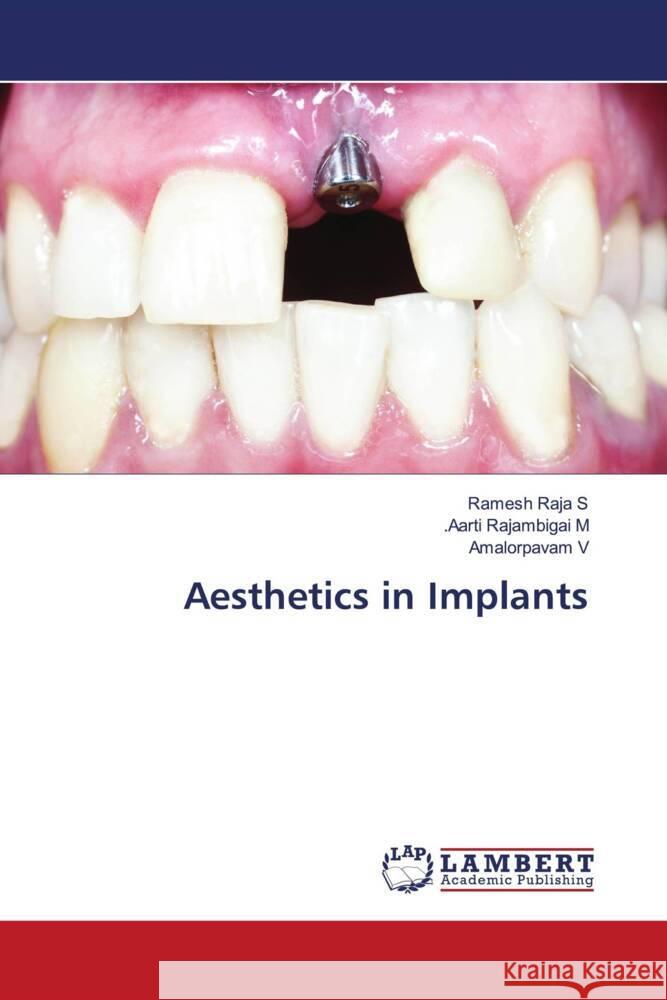 Aesthetics in Implants Raja S, Ramesh, Rajambigai M, .Aarti, V, Amalorpavam 9786204986043 LAP Lambert Academic Publishing - książka