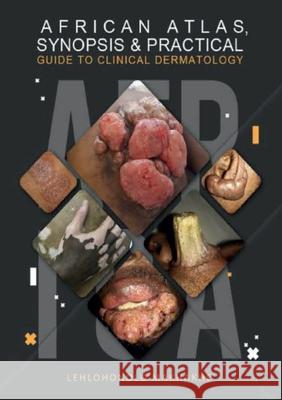 African Atlas, Synopsis & Practical Guide to Clinical Dermatology Lehlohonolo Makhakhe 9780639953915 Afrikan Brilliant Minds - książka