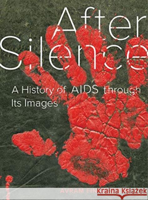 After Silence: A History of AIDS Through Its Images Avram Finkelstein 9780520351332 University of California Press - książka