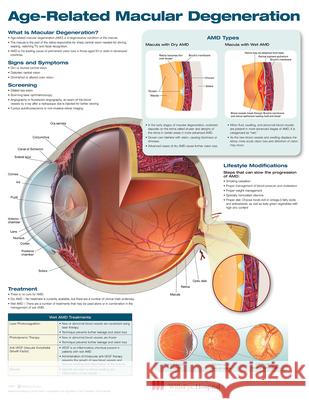 Age-Related Macular Degeneration Anatomical Chart Company 9781496381309 Acc - książka