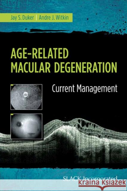 Age-Related Macular Degeneration: Current Management Jay S. Duker Andre J. Witkin 9781617116421 Slack - książka