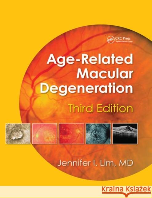 Age-Related Macular Degeneration, Third Edition Jennifer I. Lim 9780367380663 CRC Press - książka