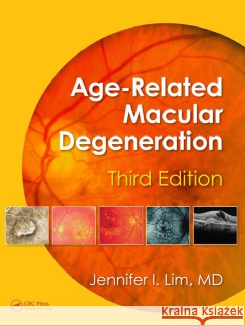 Age-Related Macular Degeneration, Third Edition Jennifer I. Lim 9781841849492 Informa Healthcare - książka