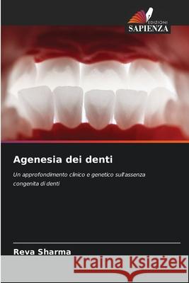 Agenesia dei denti Sharma, Reva 9786208868055 Edizioni Sapienza - książka