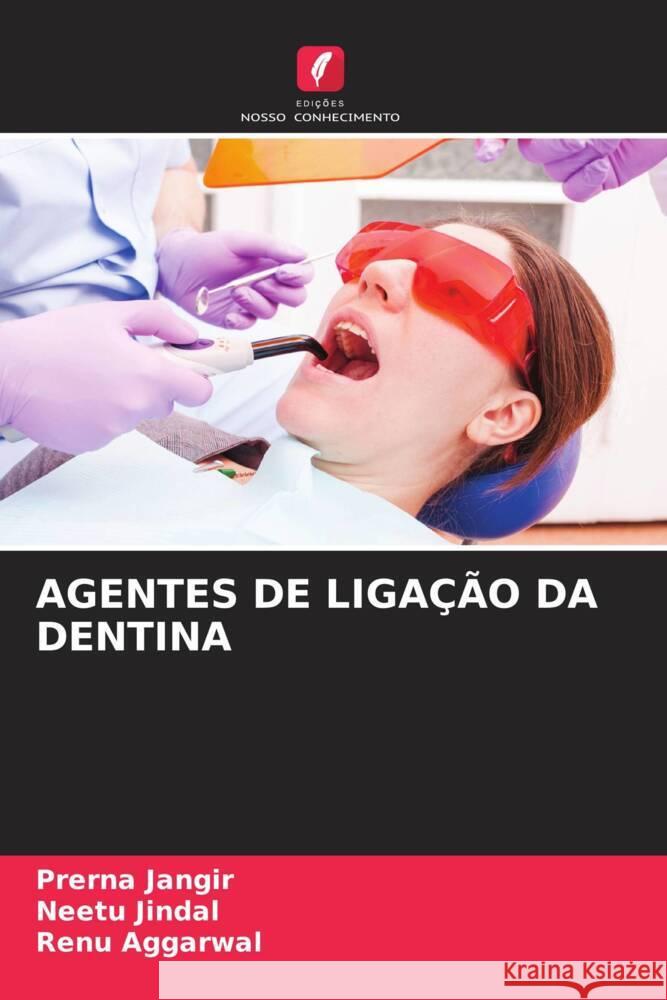 Agentes de Liga??o Da Dentina Prerna Jangir Neetu Jindal Renu Aggarwal 9786207400942 Edicoes Nosso Conhecimento - książka