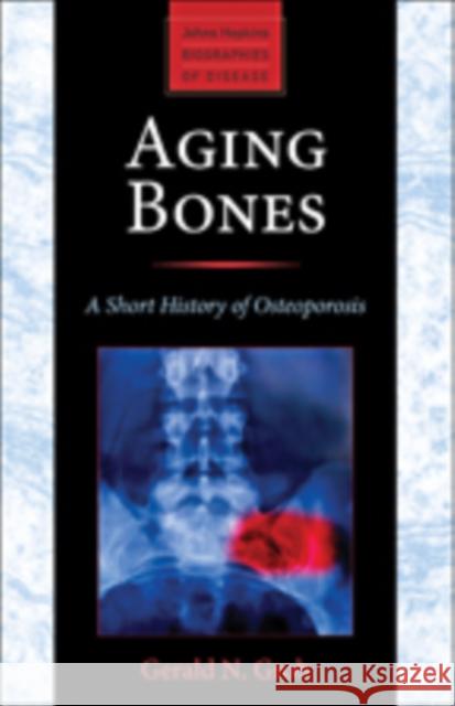 Aging Bones: A Short History of Osteoporosis Grob, Gerald N. 9781421413181 Johns Hopkins University Press - książka