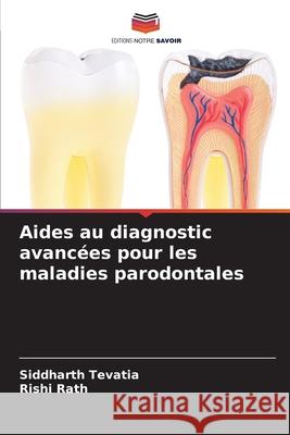 Aides au diagnostic avancées pour les maladies parodontales Tevatia, Siddharth, Rath, Rishi 9786203917703 Editions Notre Savoir - książka