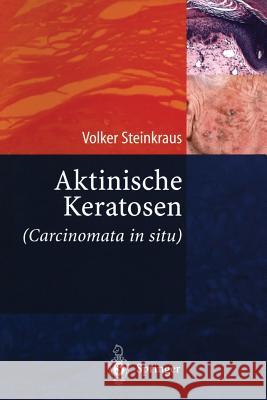Aktinische Keratosen (Carcinomata in Situ) Steinkraus, Volker 9783540210085 Springer - książka