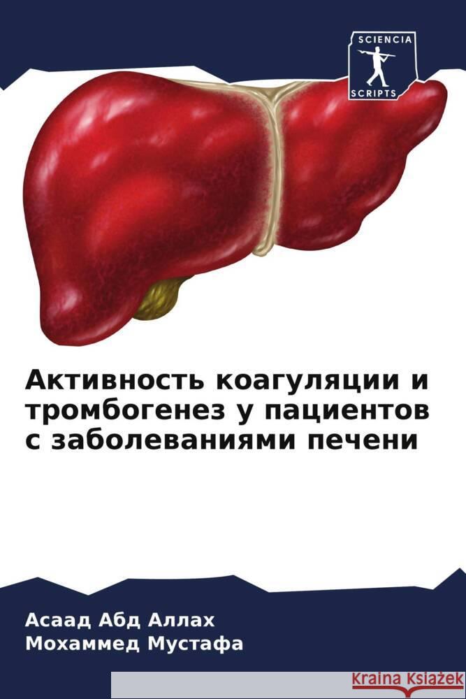 Aktiwnost' koagulqcii i trombogenez u pacientow s zabolewaniqmi pecheni Abd Allah, Asaad, Mustafa, Mohammed 9786208183196 Sciencia Scripts - książka