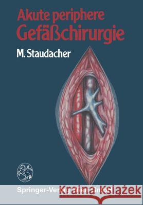 Akute Periphere Gefäßchirurgie Staudacher, M. 9783709123003 Springer - książka