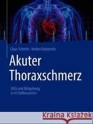 Akuter Thoraxschmerz: EKGs Und Bildgebung in 65 Fallbeispielen Claus Schmitt Andrea Radzewitz 9783662624029 Springer - książka